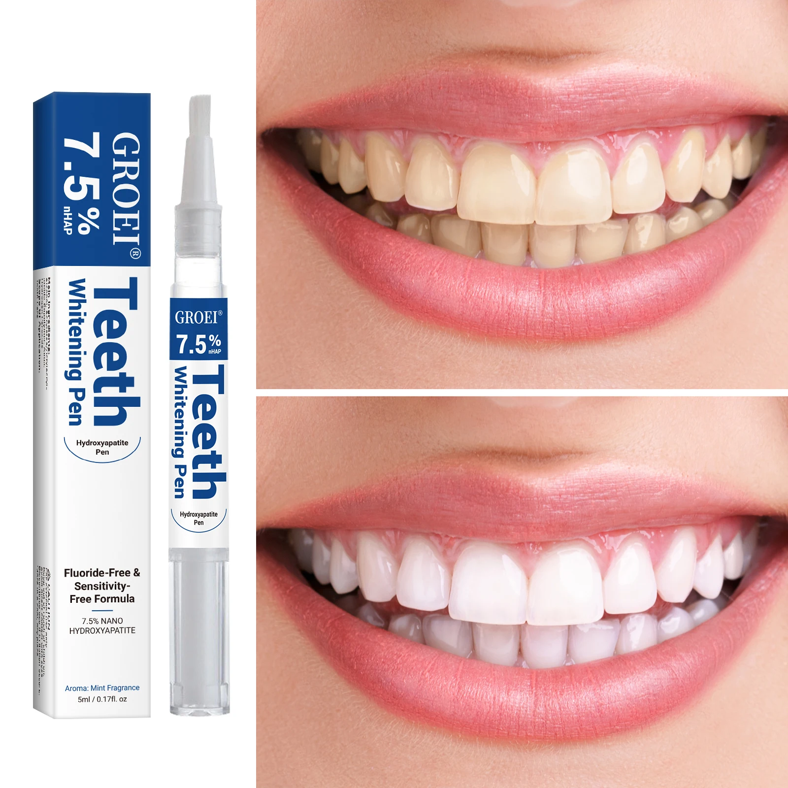 ปากกาฟอกสีฟันไฮดรอกซีอะพาไทต์  - Teeth Whitening Pens บทวิจารณ์และราคา
